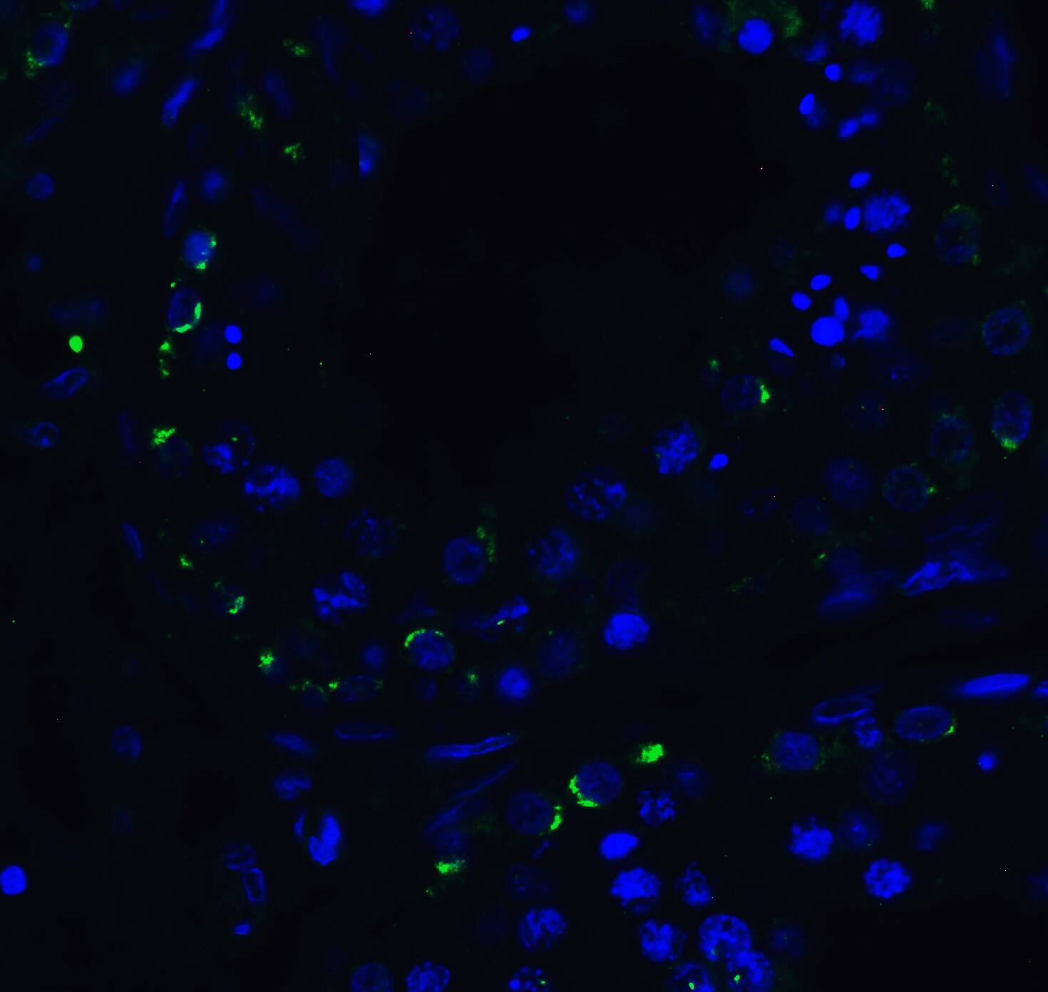 RIG-I Antibody - BSA Free