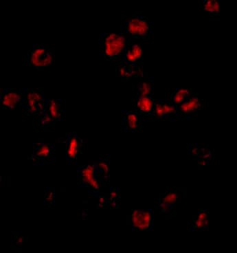SUMO1 Antibody - BSA Free