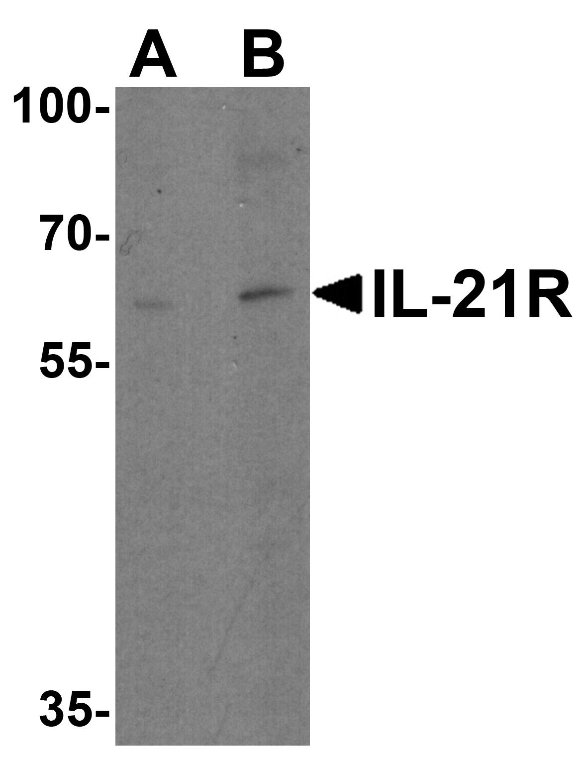 IL-21R Antibody - BSA Free