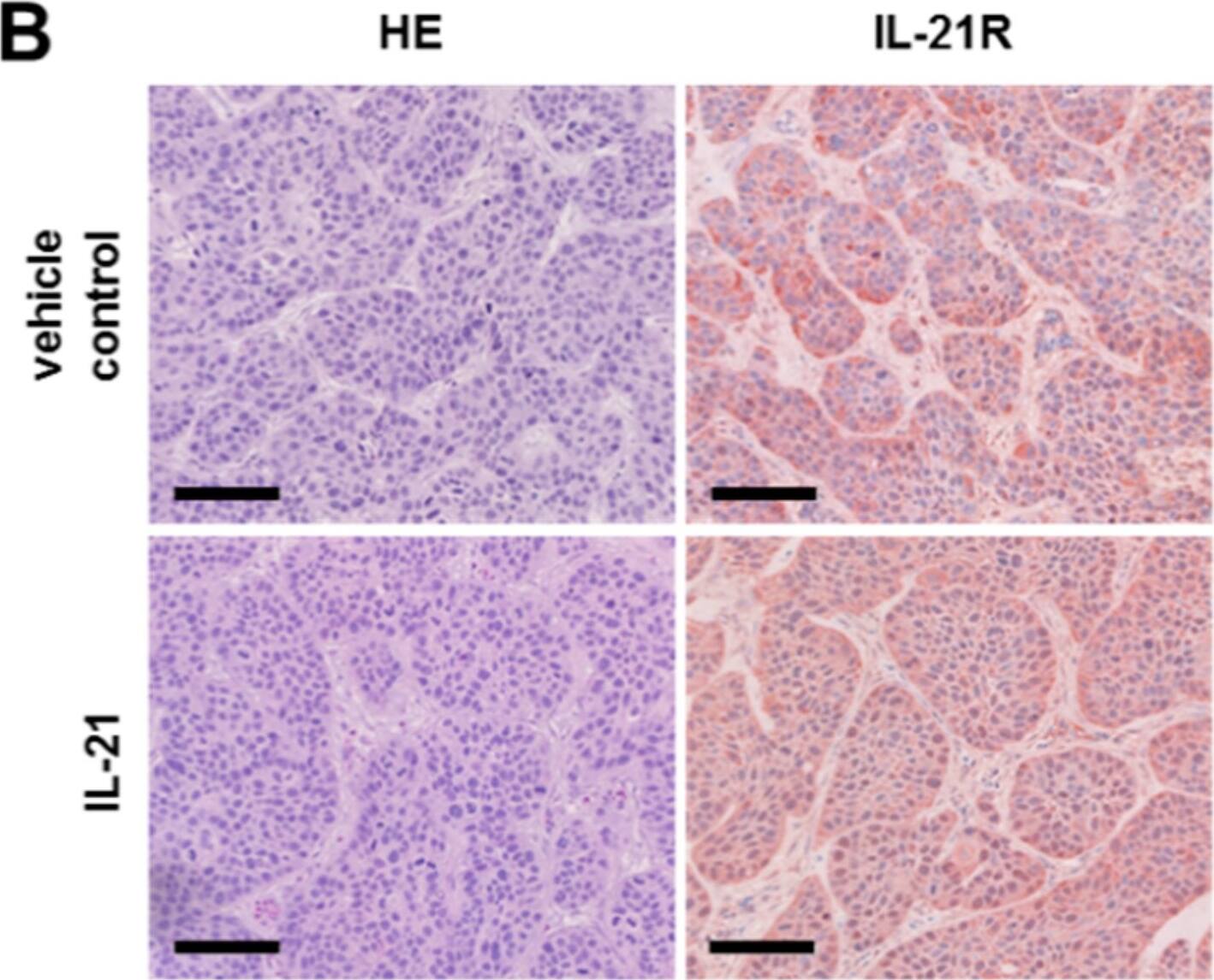 IL-21R Antibody - BSA Free