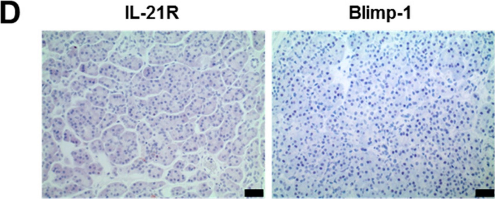 IL-21R Antibody - BSA Free