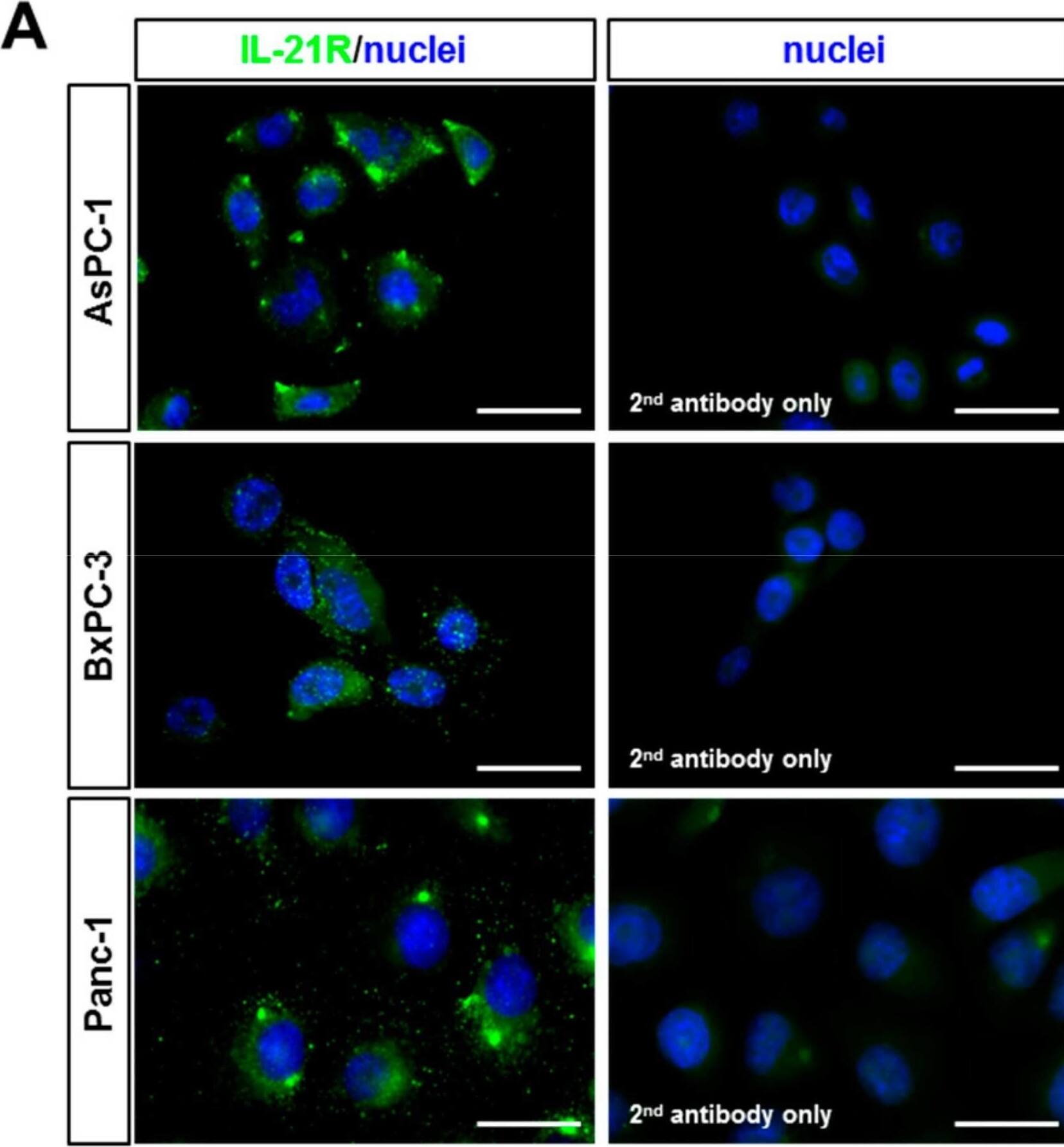 IL-21R Antibody - BSA Free
