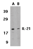 IL-21 Antibody - BSA Free