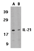 IL-21 Antibody Blocking Peptide