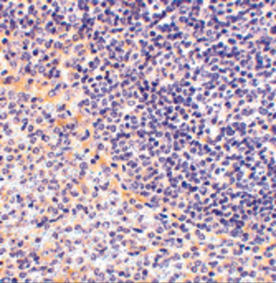FAF1 Antibody - BSA Free