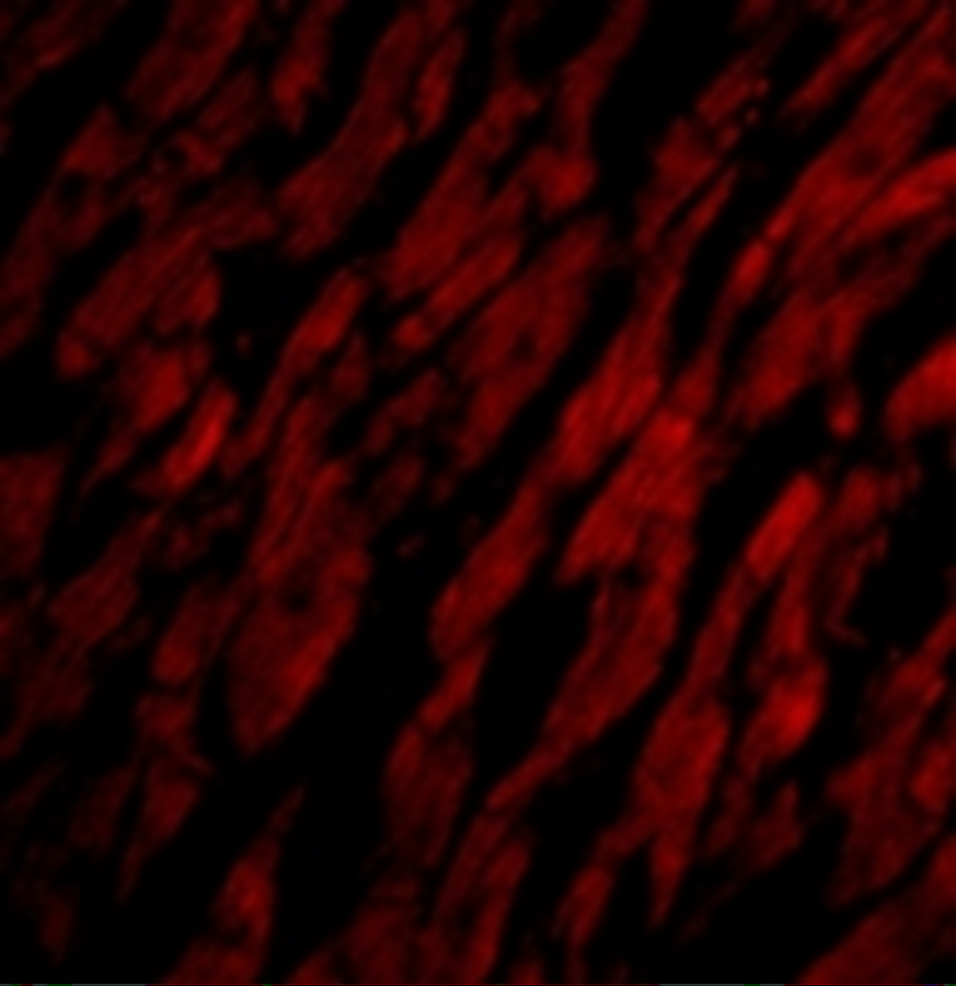 CRTH-2/GPR44 Antibody - BSA Free