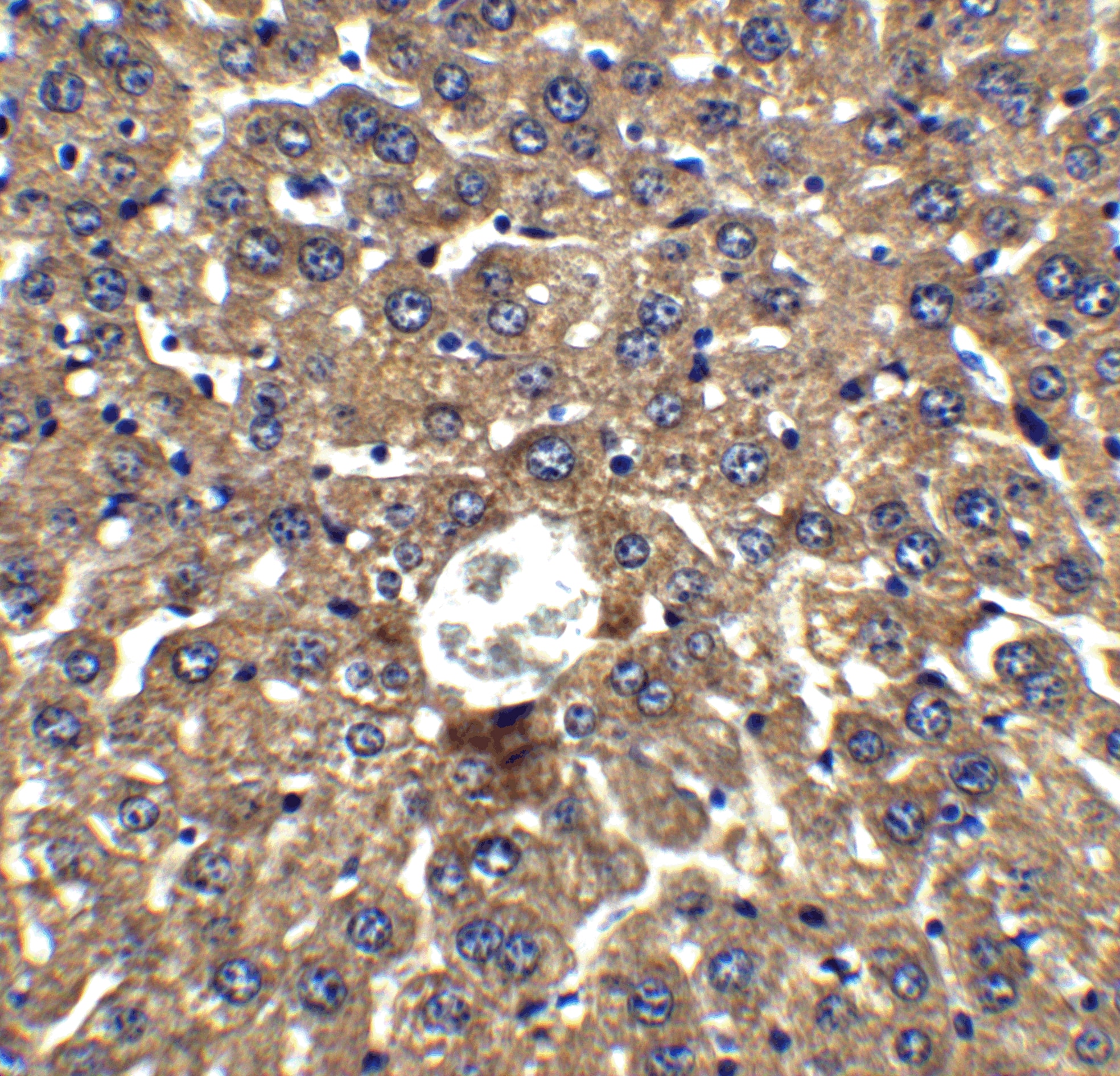 DRAM Antibody - BSA Free