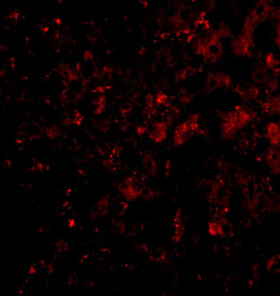 DRAM Antibody - BSA Free
