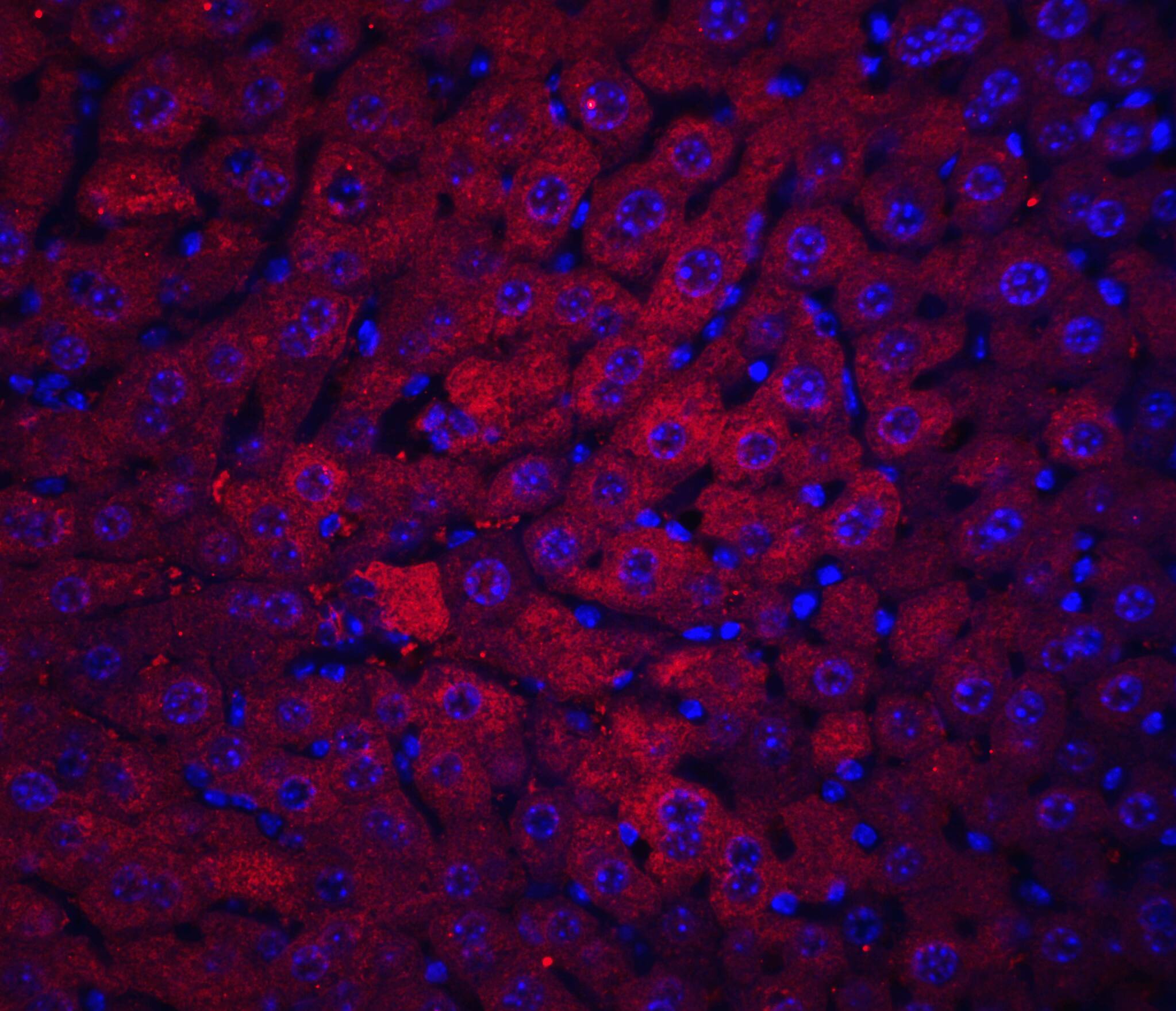 DRAM Antibody - BSA Free