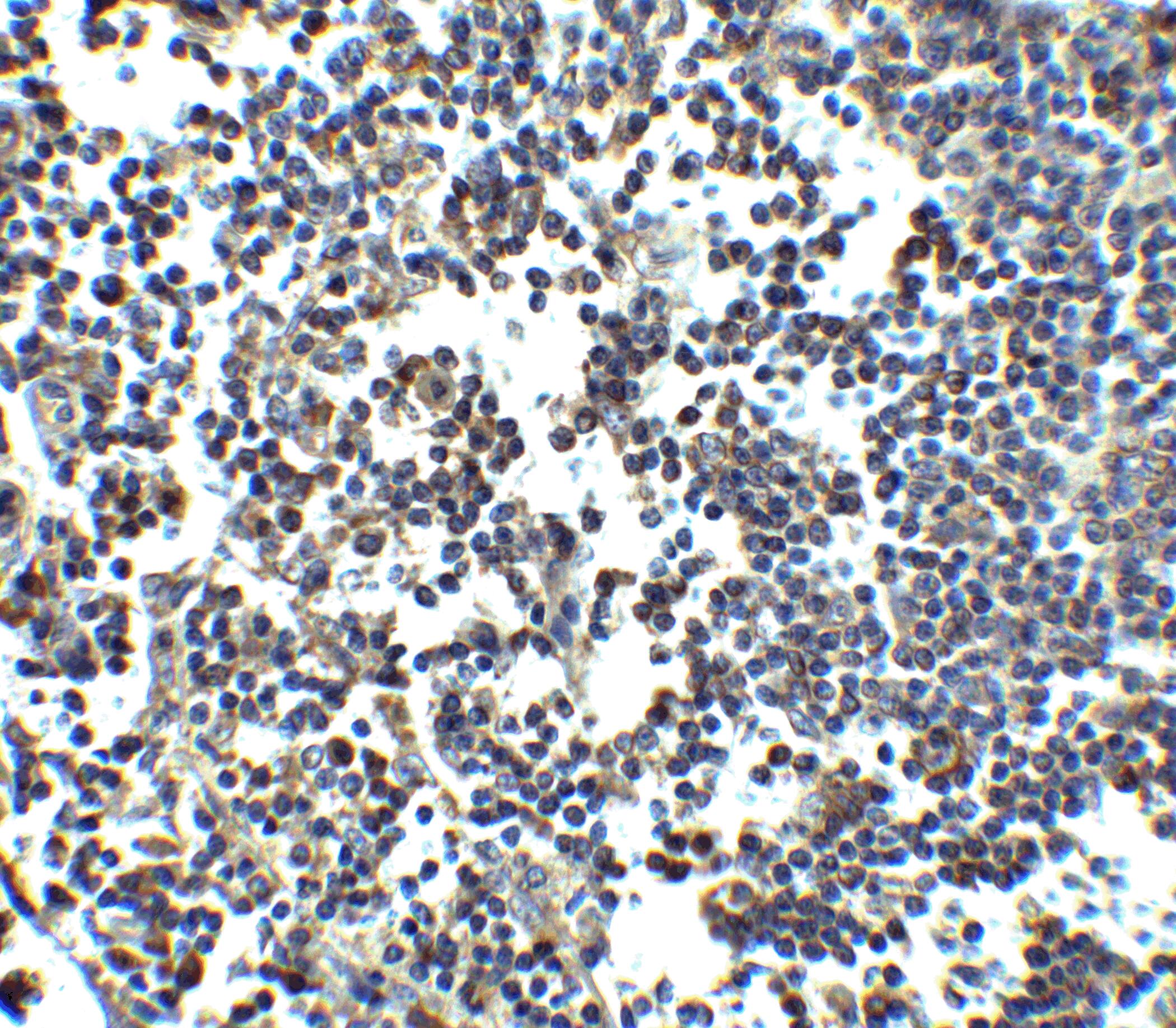 MDA5 Antibody - BSA Free