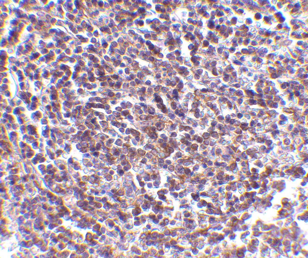 AVEN Antibody - BSA Free