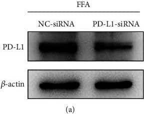PD-L1 Antibody - BSA Free