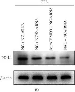 PD-L1 Antibody - BSA Free