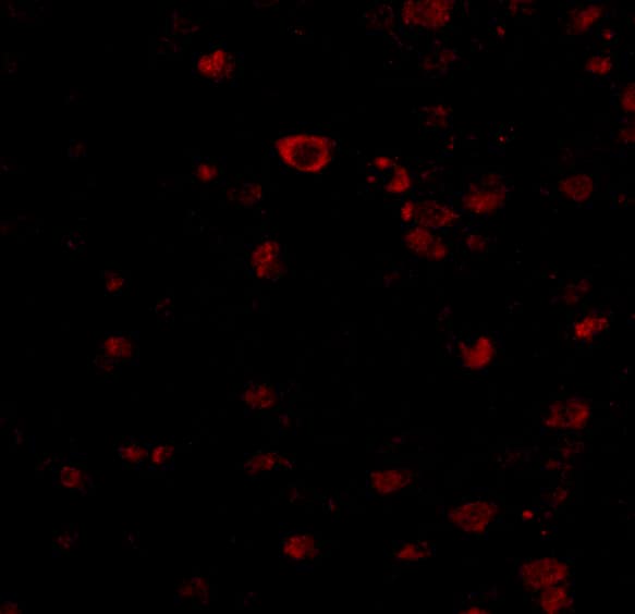 BRSK1 Antibody - BSA Free