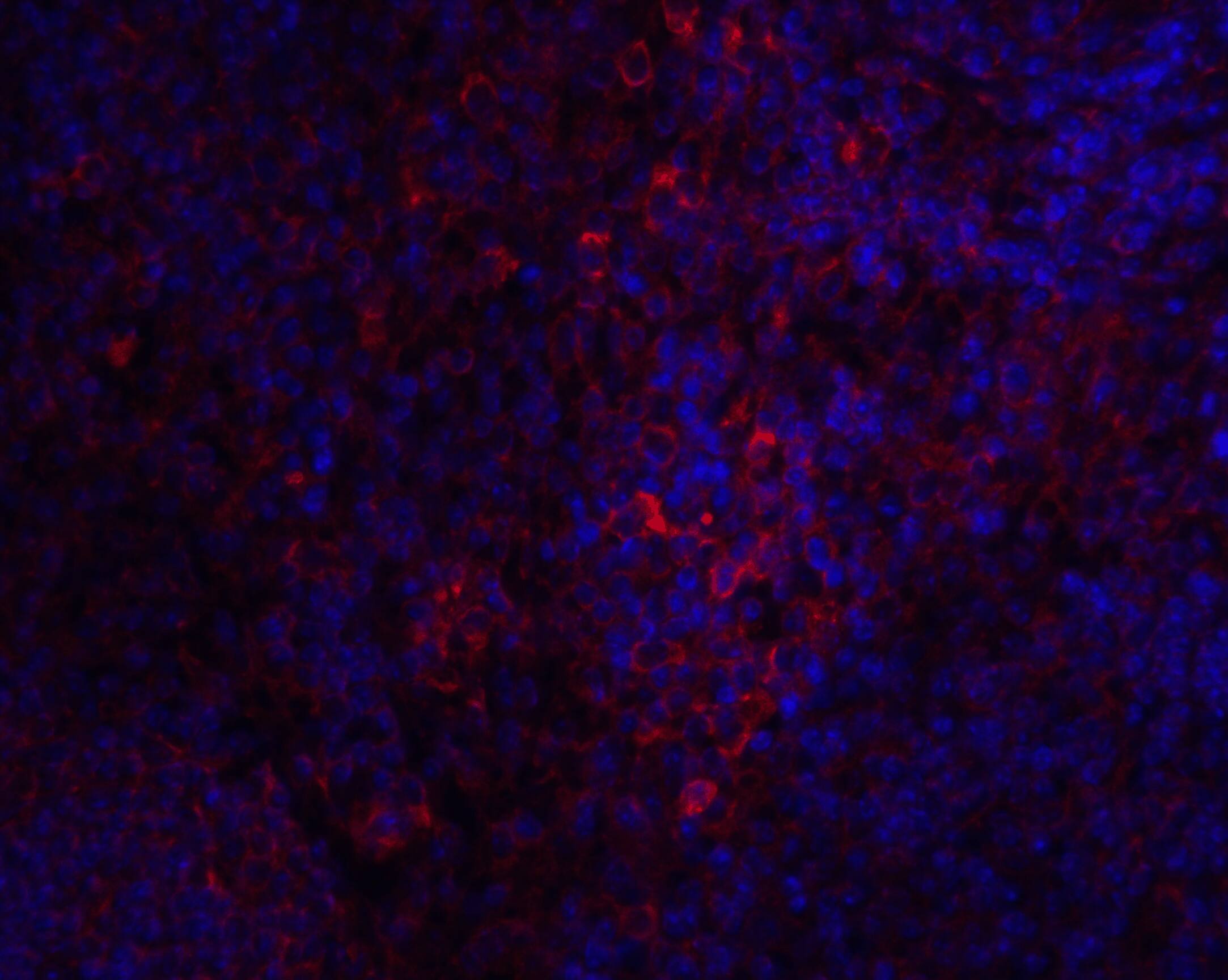 STIM1 Antibody - BSA Free