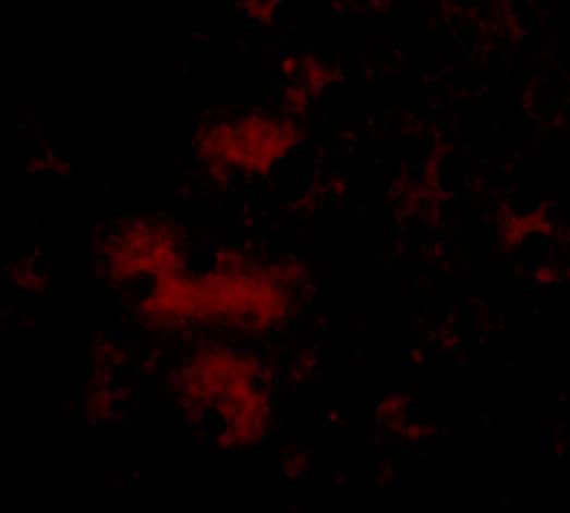 STIM2 Antibody - BSA Free