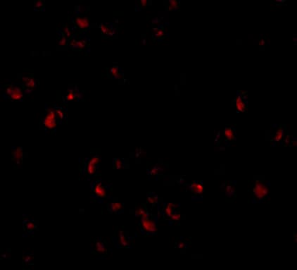 LIS1 Antibody - BSA Free