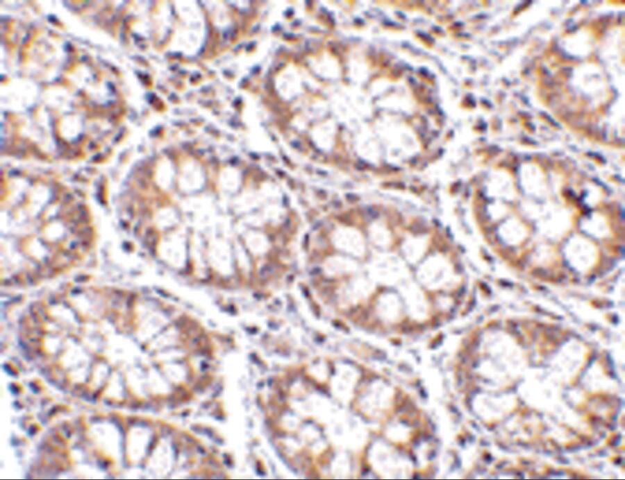 STEAP2 Antibody - BSA Free