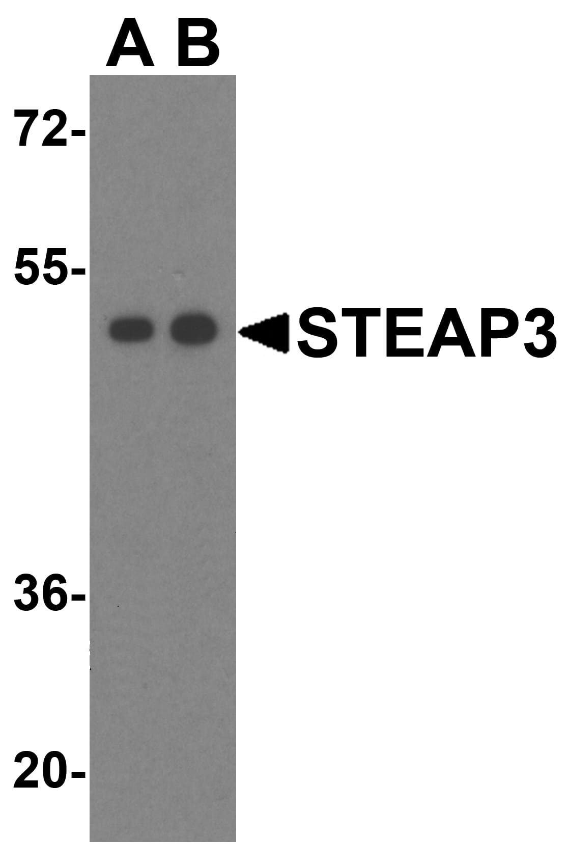 STEAP3/TSAP6 Antibody - BSA Free