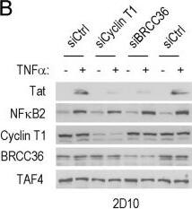 BRCC3 Antibody - BSA Free