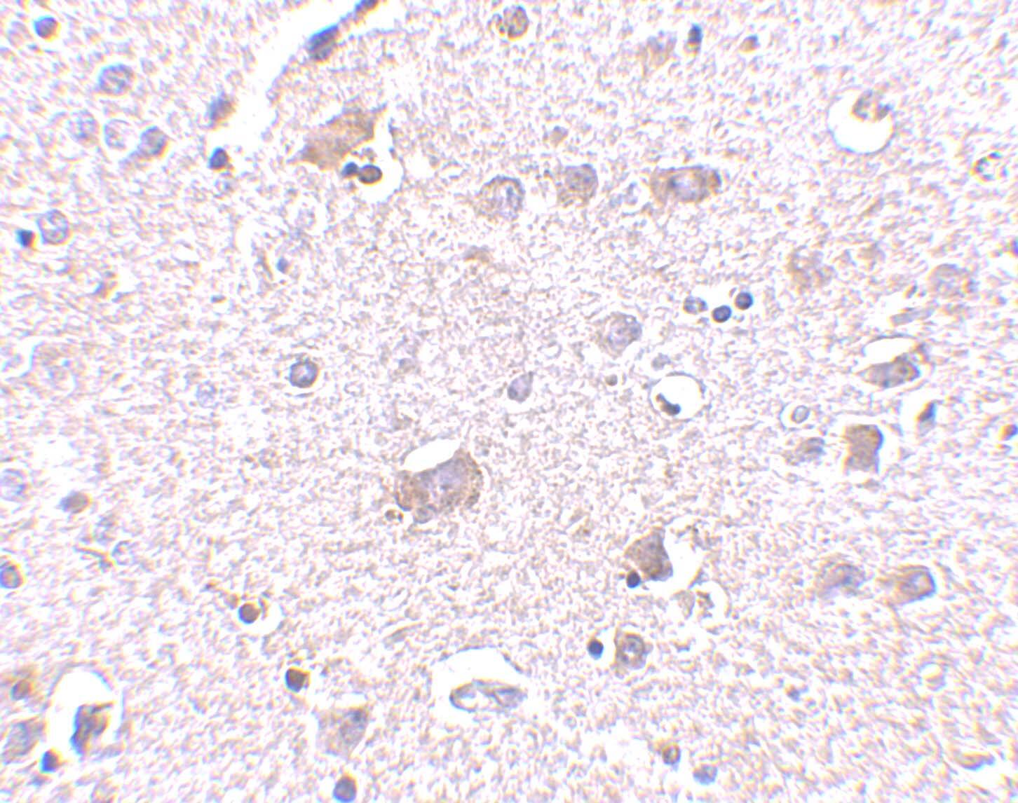 CDNF Antibody - BSA Free
