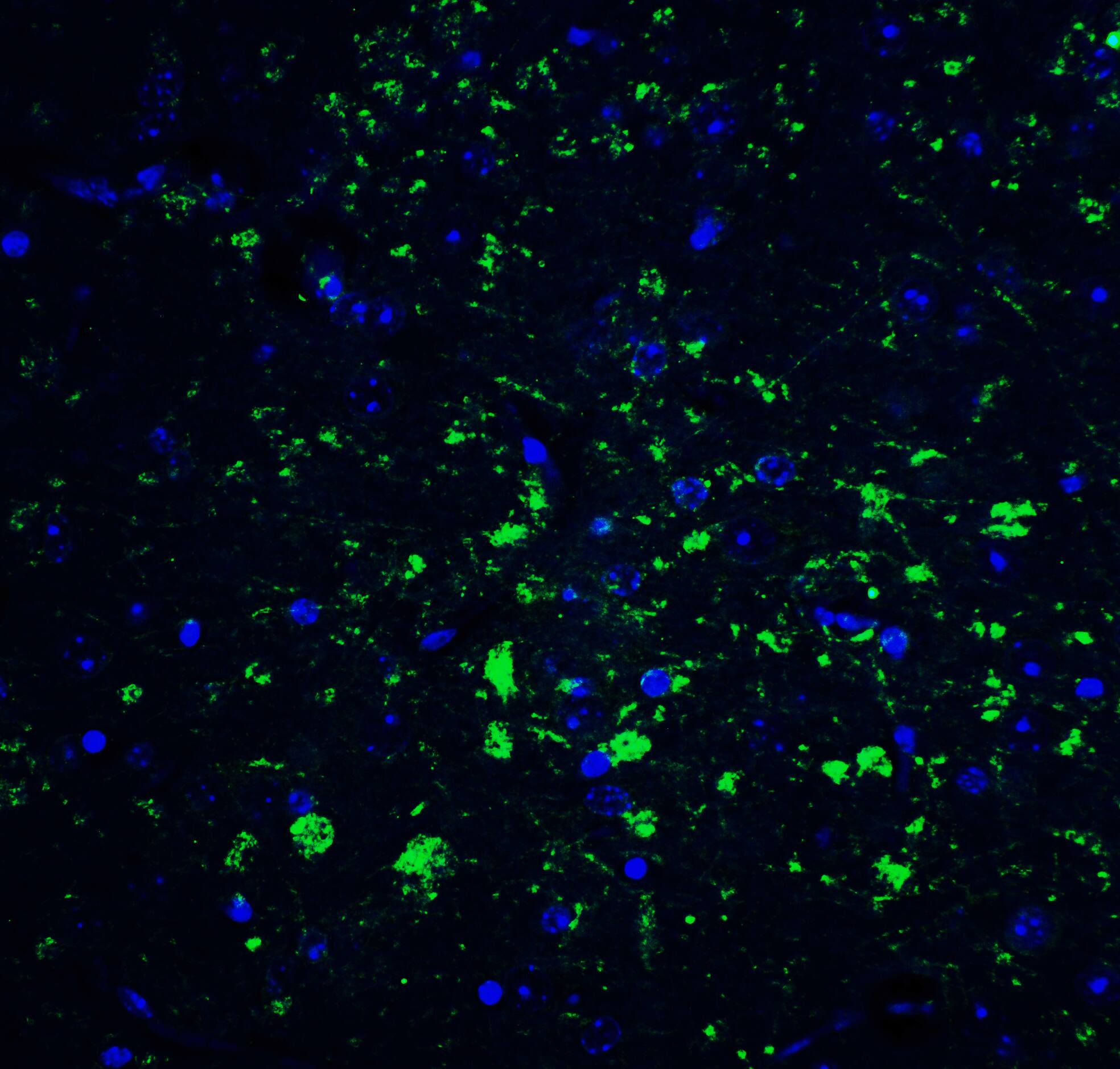 CDNF Antibody - BSA Free