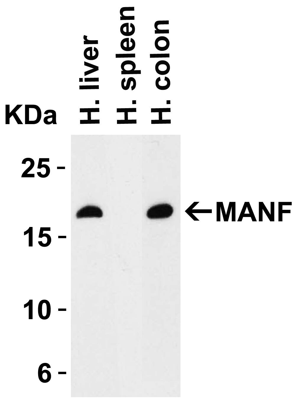 MANF Antibody - BSA Free
