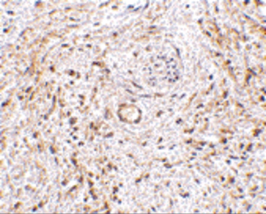 TEM5/GPR124 Antibody - BSA Free