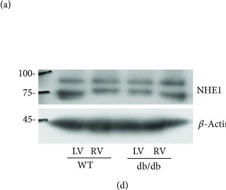 NHE1/SLC9A1 Antibody - BSA Free
