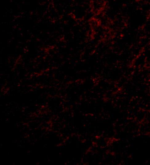 NHE1/SLC9A1 Antibody - BSA Free