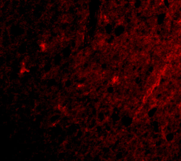 GluR5/GRIK1 Antibody - BSA Free