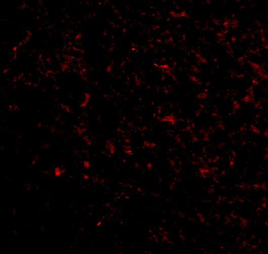 KA2/GRIK5/Glutamate Receptor KA2 Antibody - BSA Free