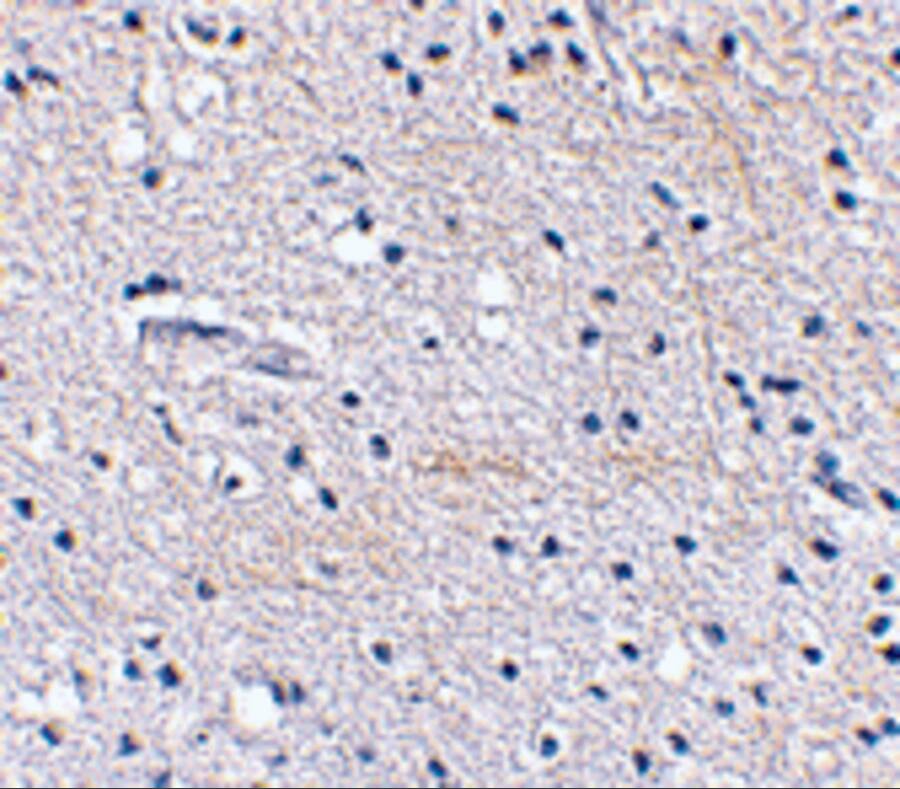 FBXL20 Antibody - BSA Free