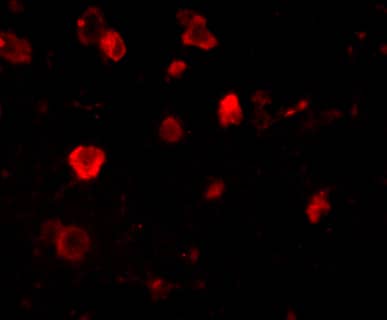 SLITRK4 Antibody - BSA Free