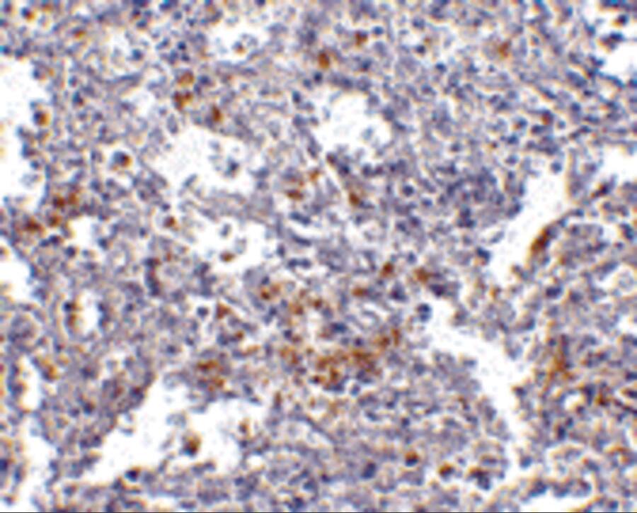 TMC6 Antibody - BSA Free