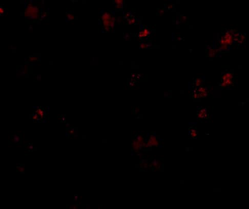 TMC6 Antibody - BSA Free