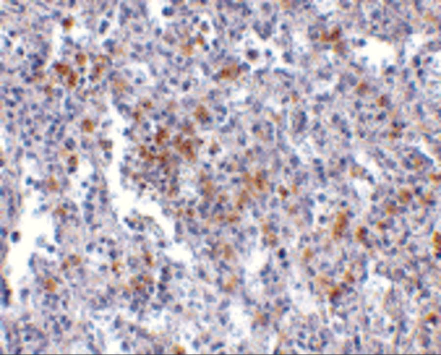 TMC6 Antibody - BSA Free