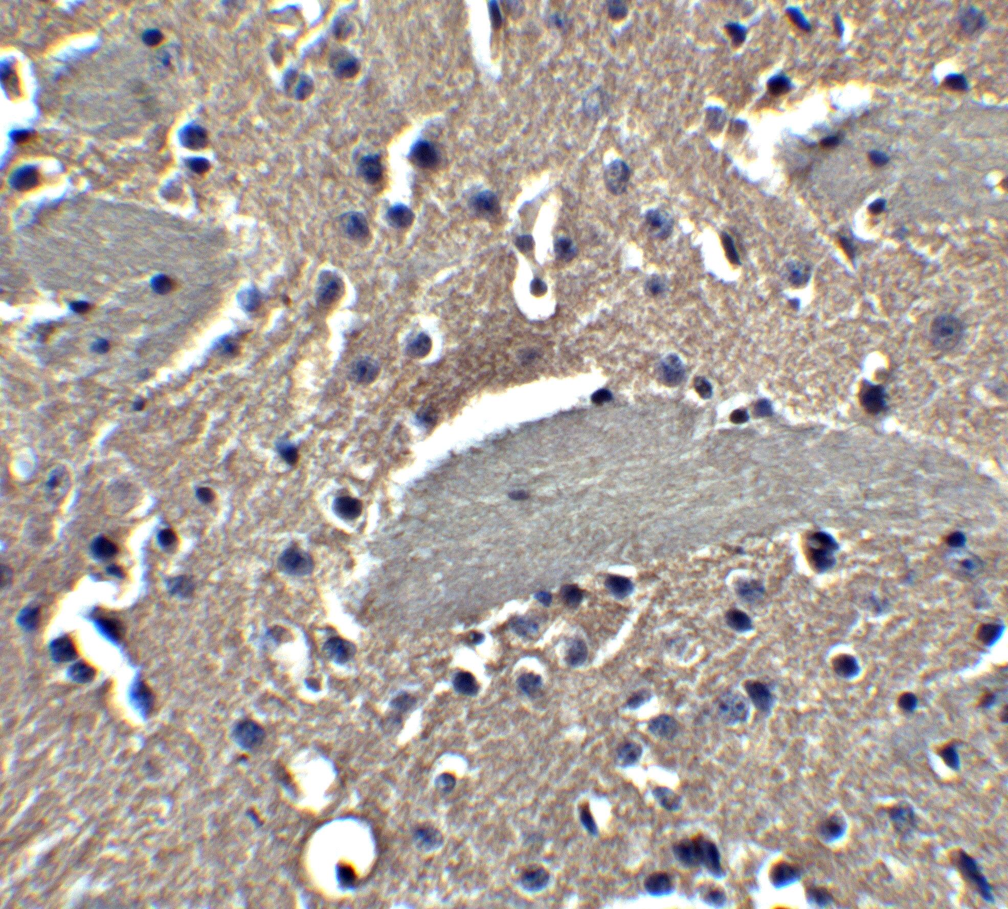Neuronal Pentraxin 2 Antibody - BSA Free