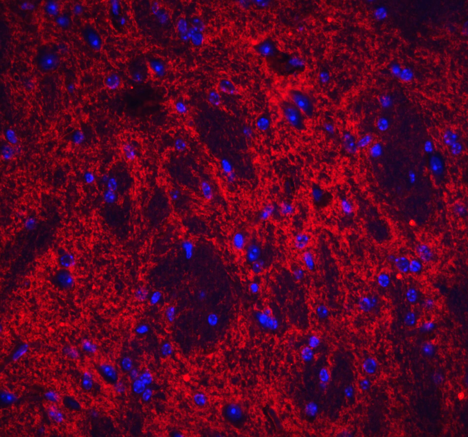 Neuronal Pentraxin 2 Antibody - BSA Free