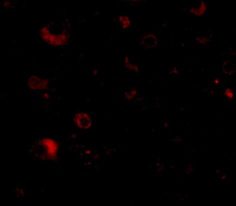 RIMS2 Antibody - BSA Free