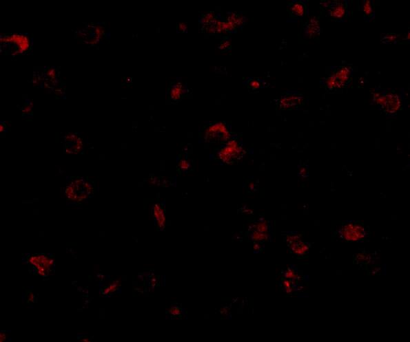 GKAP/DLGAP1 Antibody - BSA Free