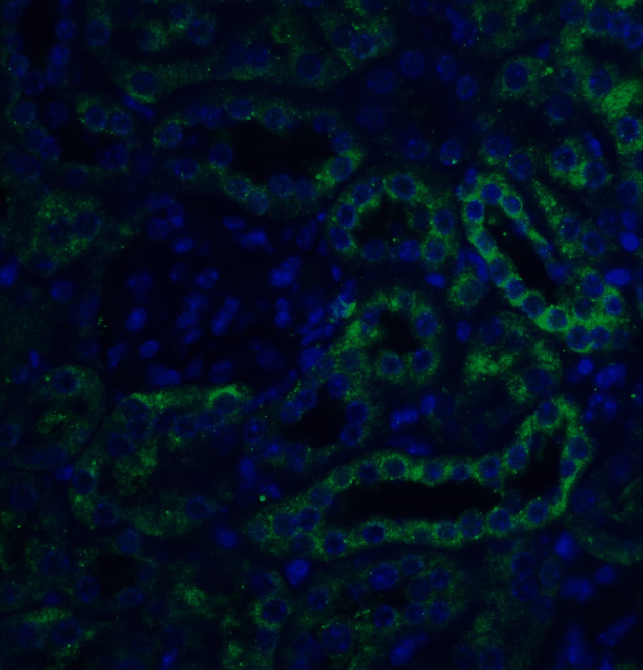 SLC22A17 Antibody - BSA Free