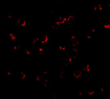 BICD1 Antibody - BSA Free