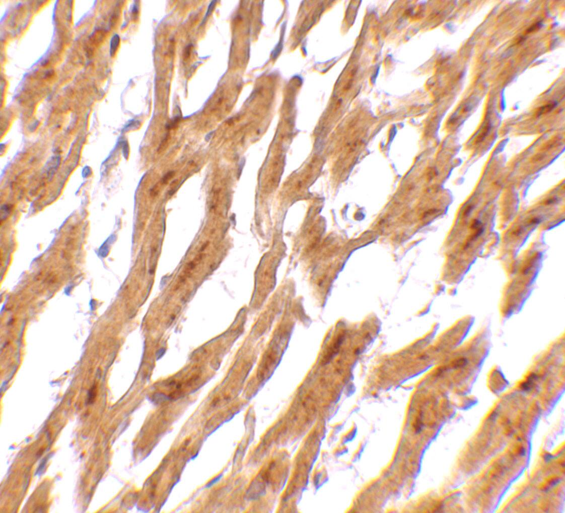 ASAH1 Antibody - BSA Free