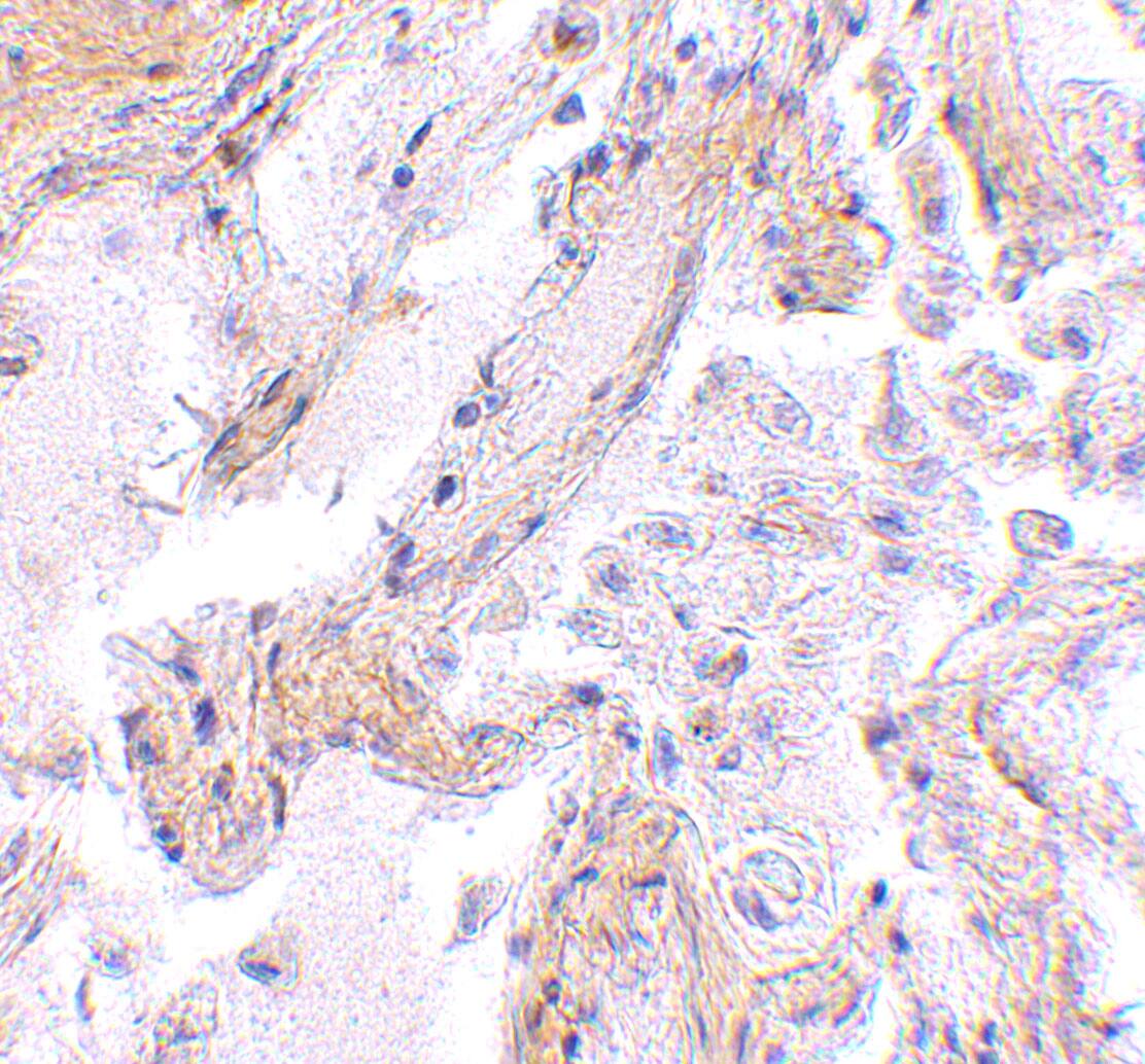 Calpain 6 Antibody - BSA Free