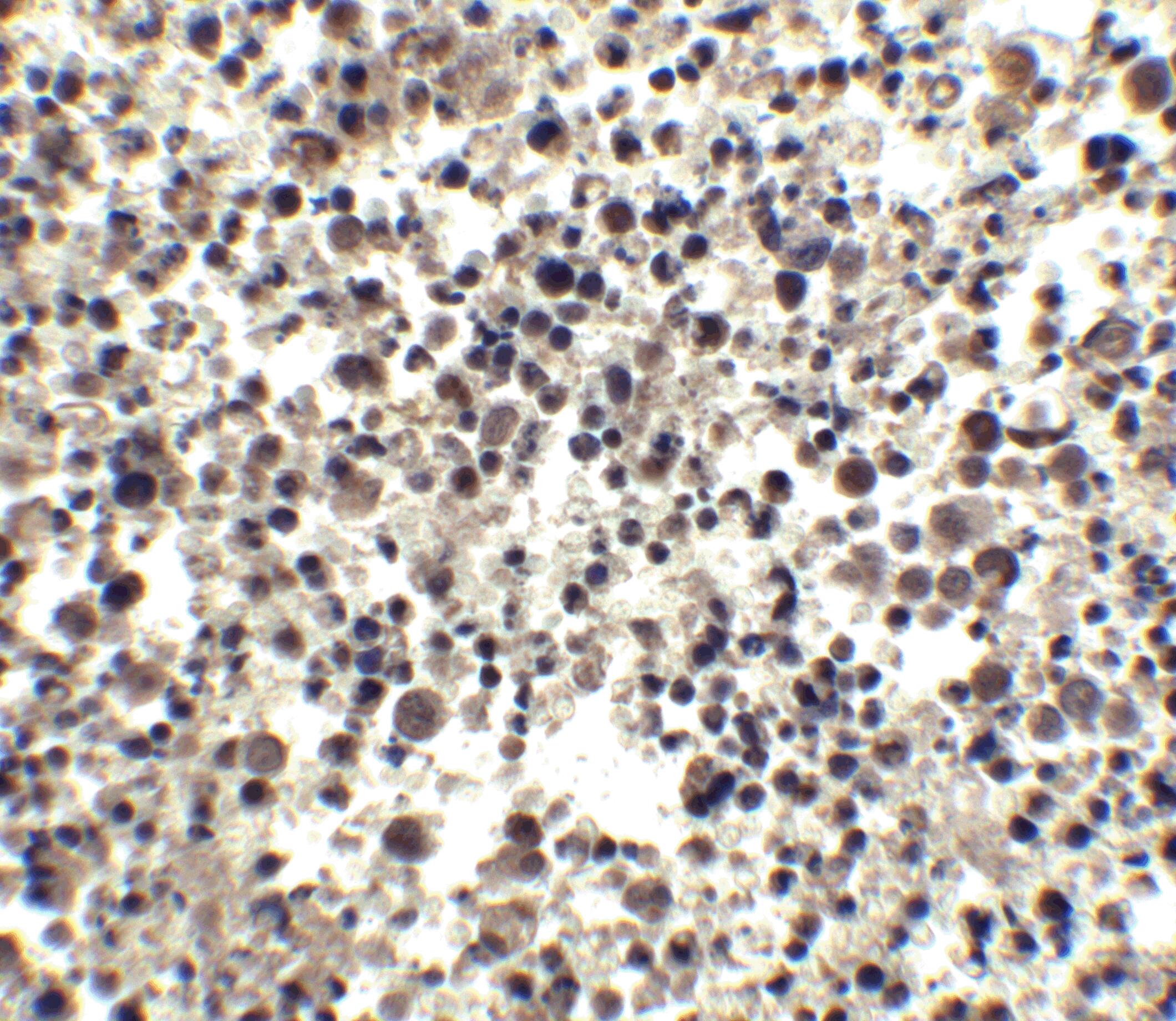 CIDEA Antibody - BSA Free