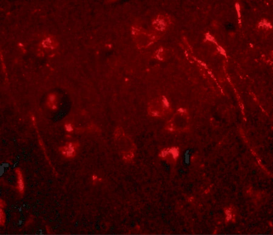 AIPL1 Antibody - BSA Free