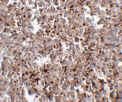 METTL7B Antibody - BSA Free
