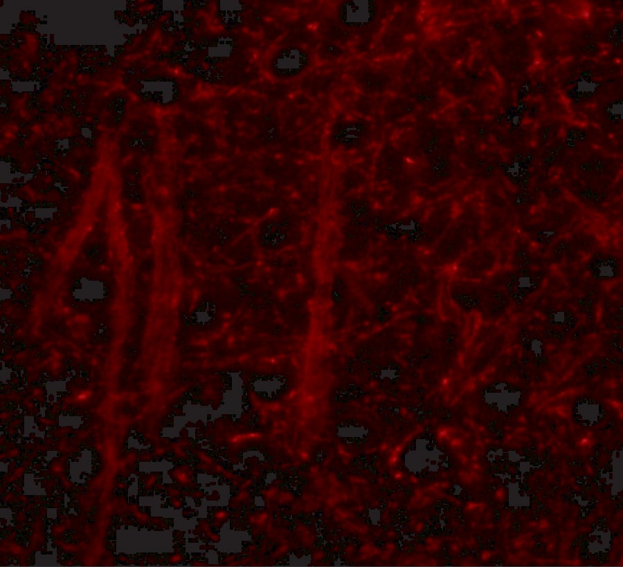 GLE1 Antibody - BSA Free