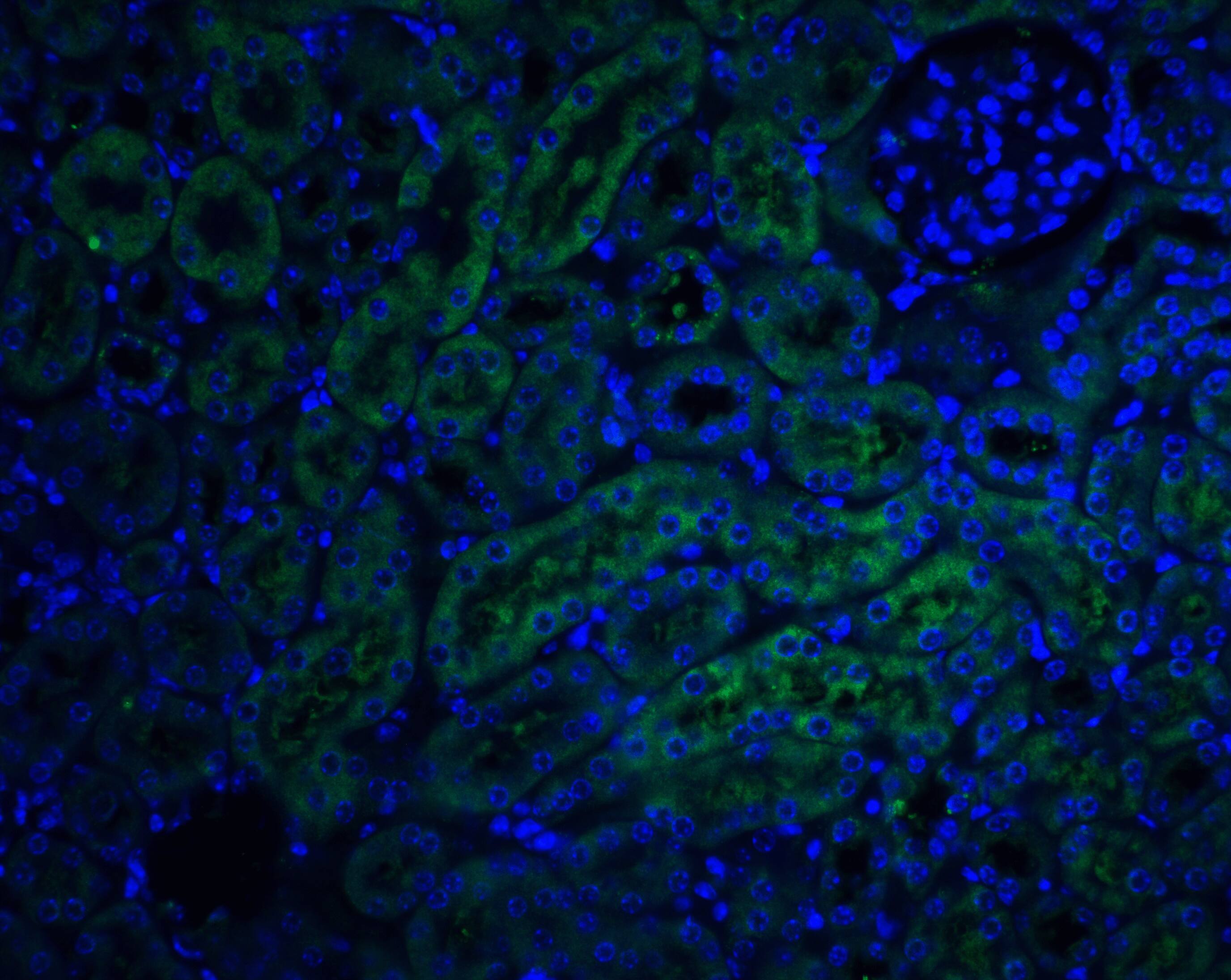 TRAILR4/TNFRSF10D/DcR2 Antibody - BSA Free
